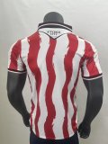 Stoke City Home Fans 1:1 Quality  Soccer Jersey 25/26