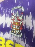 Stoke City Away Fans 1:1 Quality  Soccer Jersey 25/26