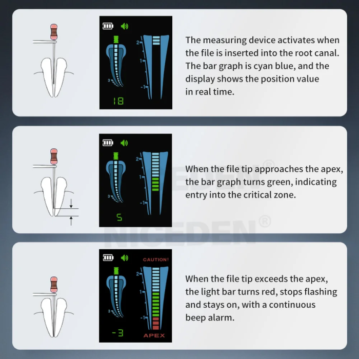 Dental Endo Apex Locator Root Canal Apex Location Periodontics Measurement Measuring Equipment Dentistry Tool New Color Display