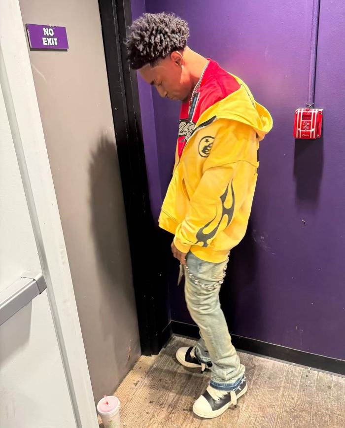 [Big & Tall for weights up to 260 lbs]1:1 quality version Washed Yellow Chest Double Logo Print Zipper  Hoodie with NFC tag