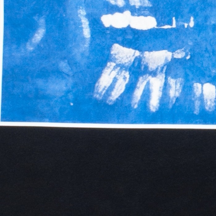 Vintage Dental X-Ray Print Washed Tee 29306196